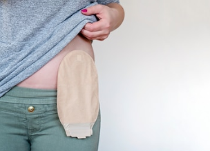Ostomy