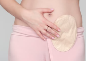 Stoma