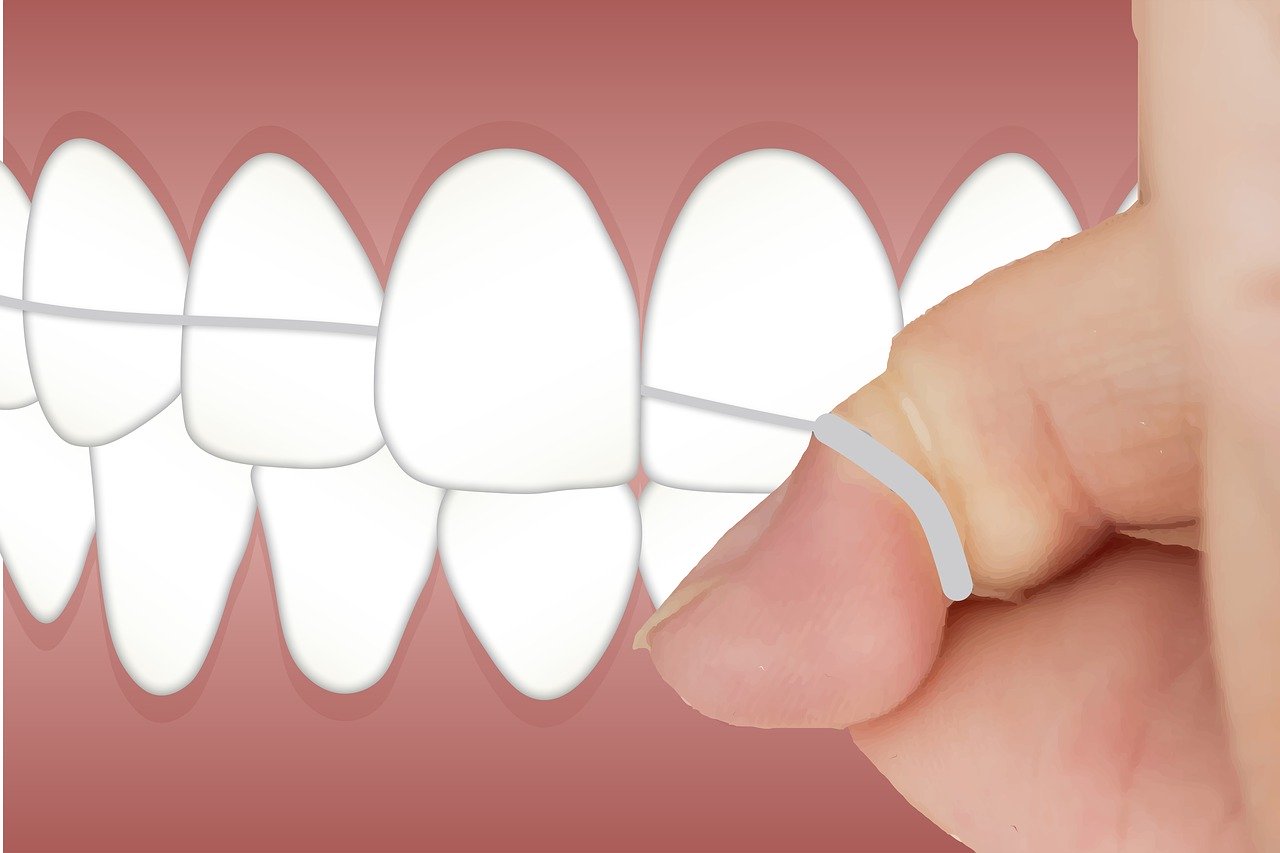 Floss